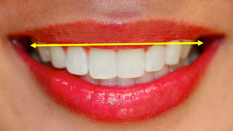 Как выглядит правильный прикус