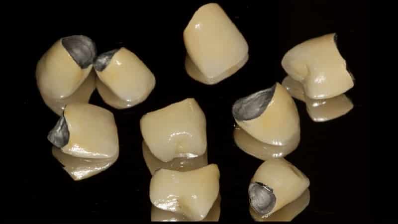 когда можно протезировать после удаления зуба