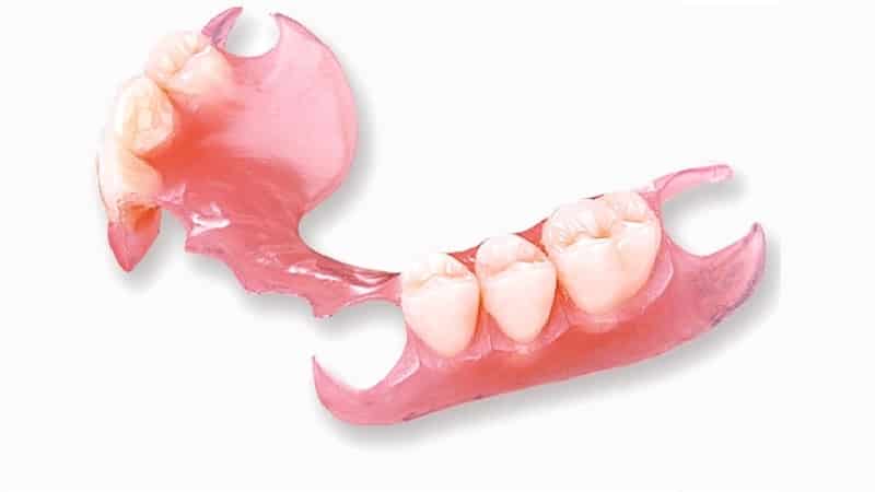 вставить зуб без обточки соседних зубов