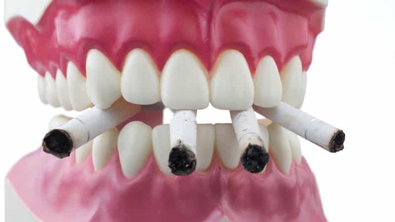 рак десен причины