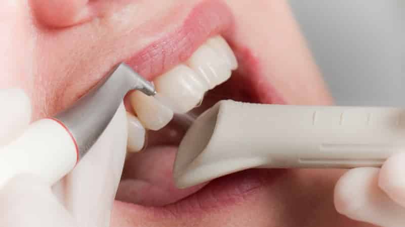 полость рта санирована что это значит