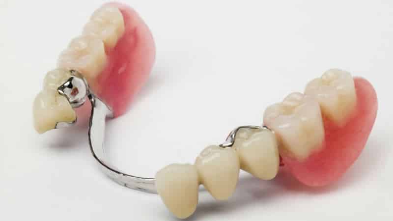 полное протезирование зубов