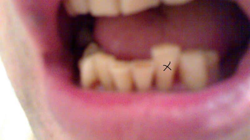 приснилось что шатается зуб