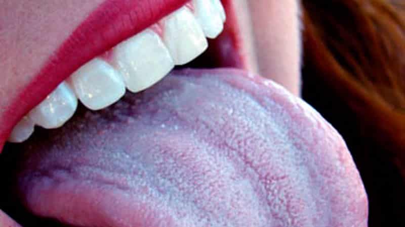 Синий налет на языке