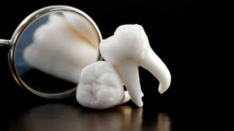 сколько каналов в зубах