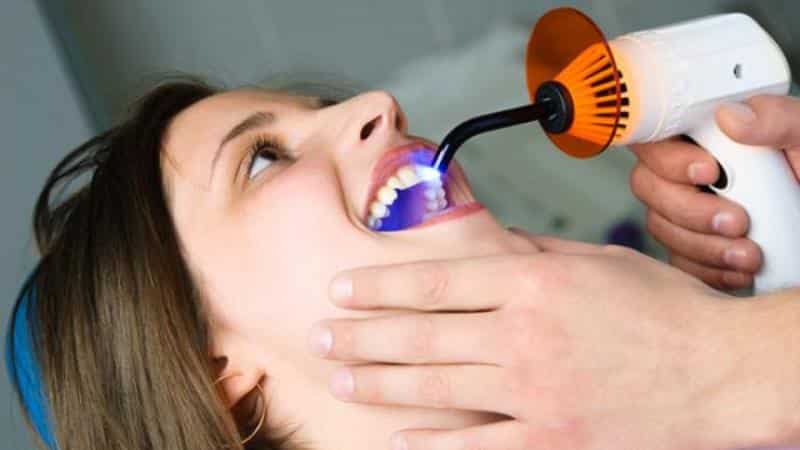 сколько нельзя есть после пломбирования зуба