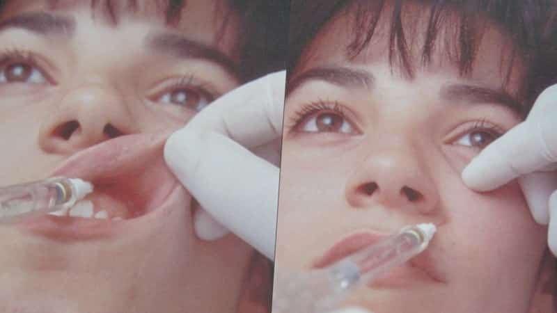 не проходит анестезия после лечения зуба