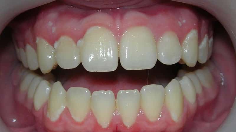 сколько по времени нужно чистить зубы