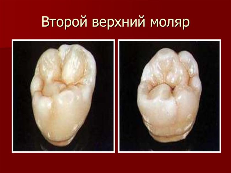 Моляры и премоляры: что это за зубы