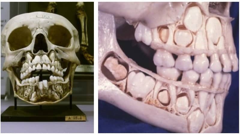 смена зубов у детей схема