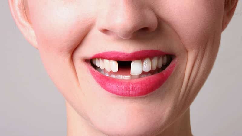 Сон о выпавшем зубе