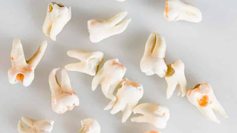 К чему снятся выпавшие зубы?