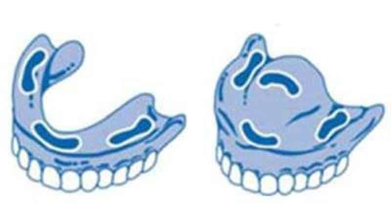 корега крем для фиксации зубных протезов инструкция