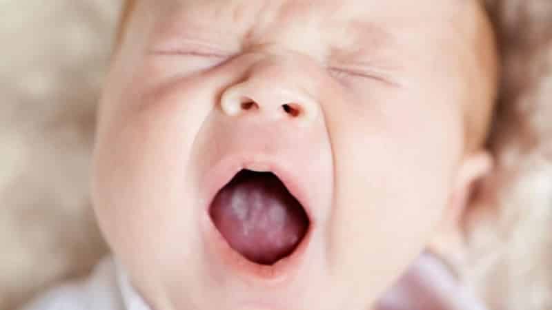 стоматит на языке у ребенка лечение