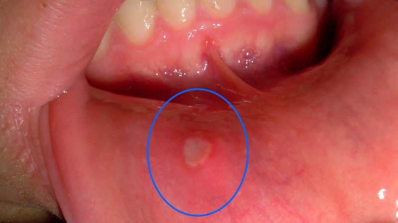 причины у ребенка