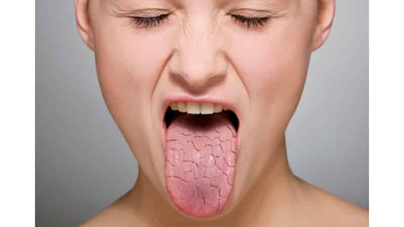 Что делать, если постоянно сушит и горчит во рту