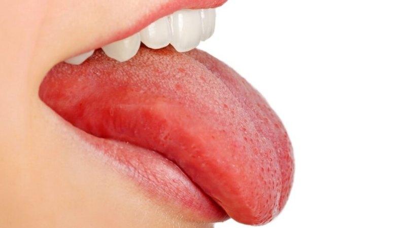 высыпание на языке лечение