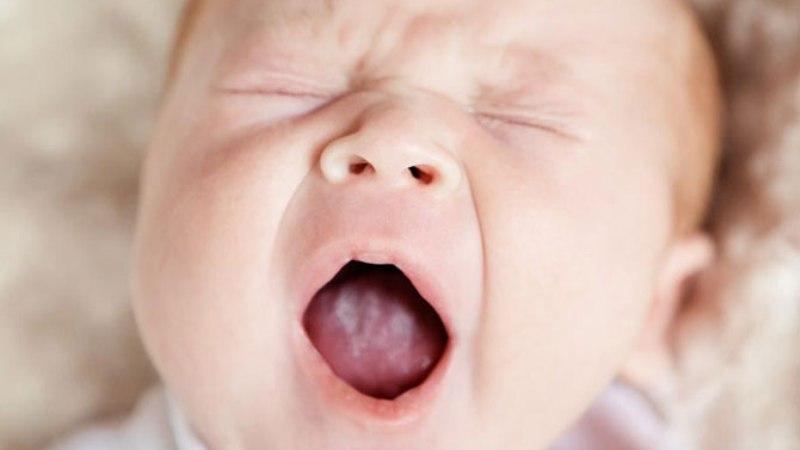 сыпь на языке у ребенка фото