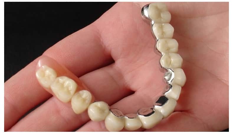 бюгельные протезы на телескопических коронках фото