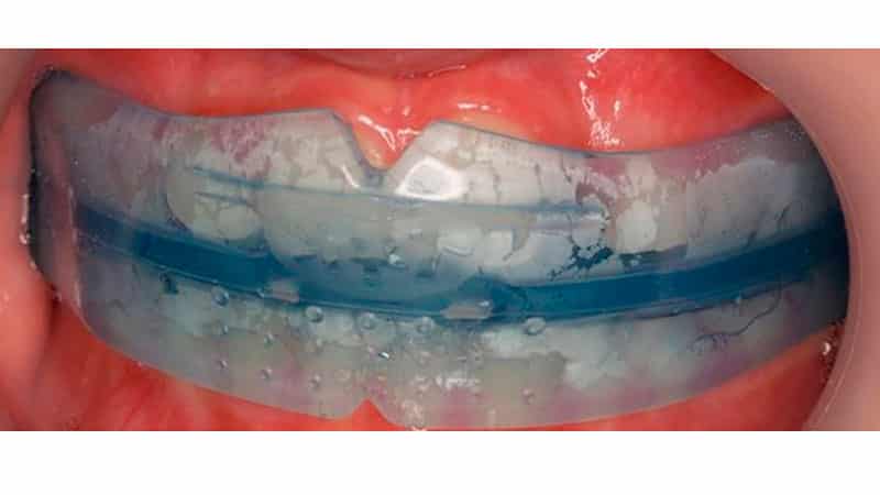 Как носить трейнеры