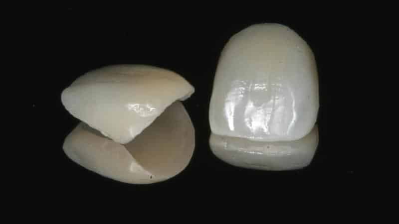 коронки из диоксида циркония фото