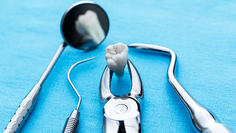 Инструменты для удаления верхнего зуба мудрости