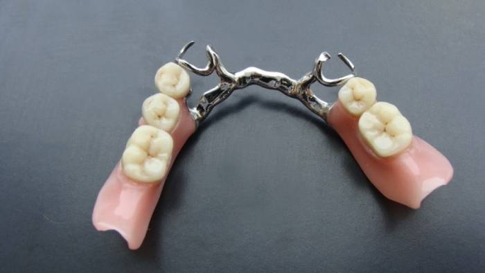 уход за бюгельными зубными протезами