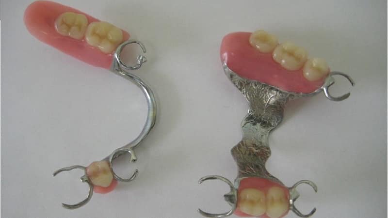 как ухаживать за бюгельными зубными протезами и чем их чистить