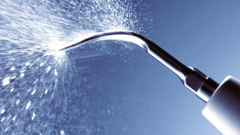 ультразвуковая чистка зубов противопоказания при беременности