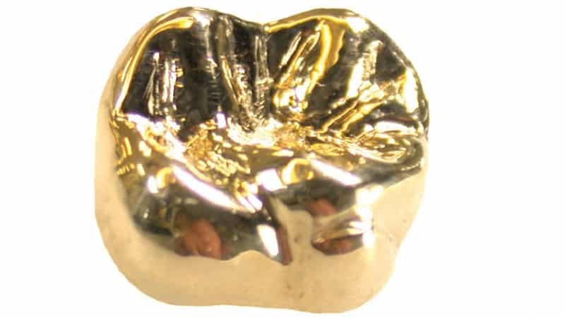 виды зубных коронок