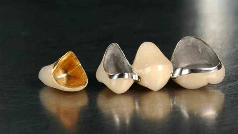 коронка на зуб сколько стоит