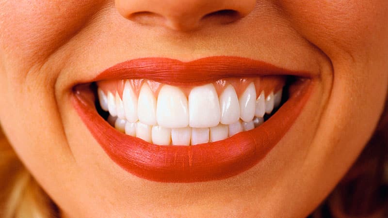 Сколько стоит поставить виниры на зубы