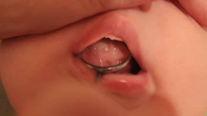 белые десна у грудничка