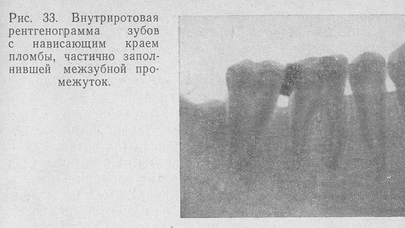 Причины воспаления десны