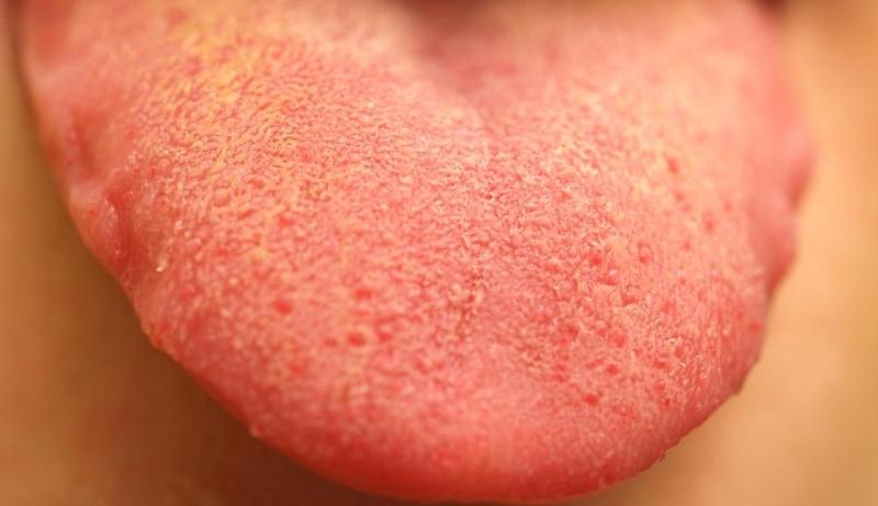 воспаление кончика языка