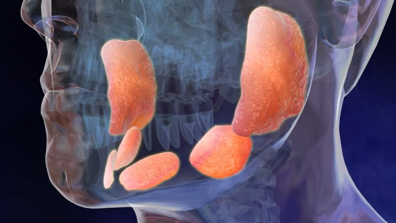 воспаление под языком фото причины