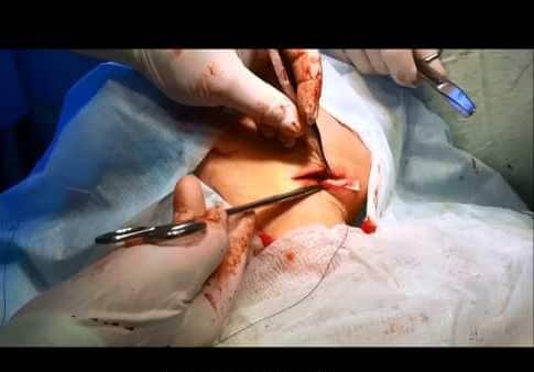 воспалились опухли лимфоузлы под челюстью фото