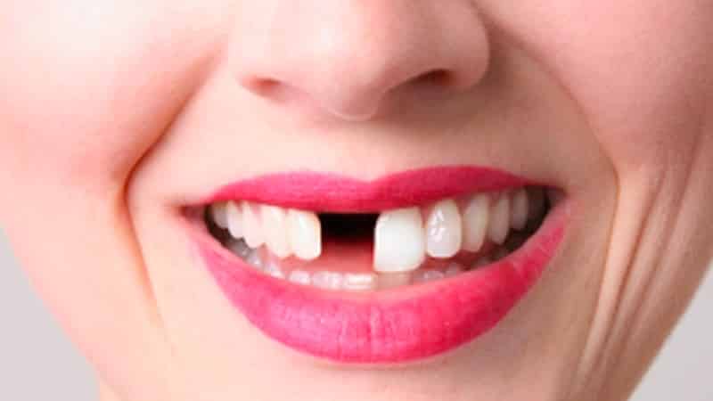 вырвать зуб во сне с кровью