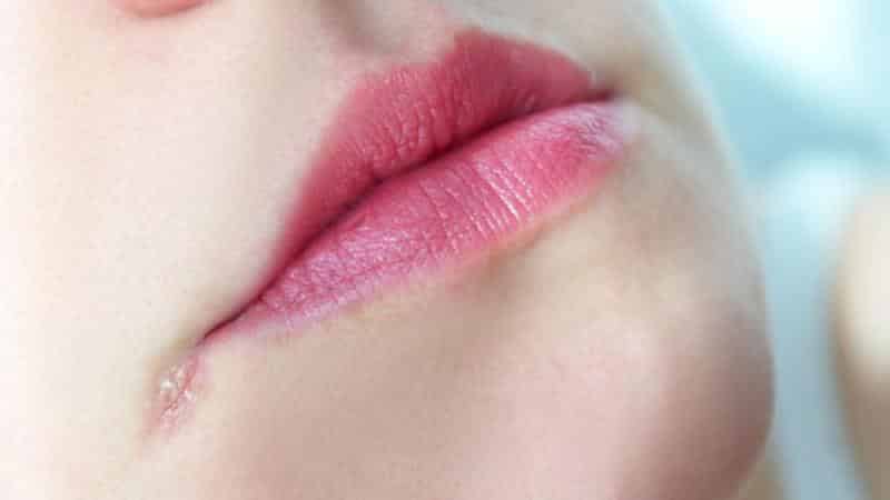 , болезни ротовой полости у взрослых