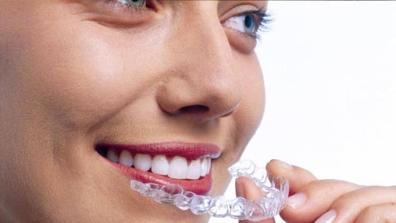 зачем нужна детская капа для зубов фото