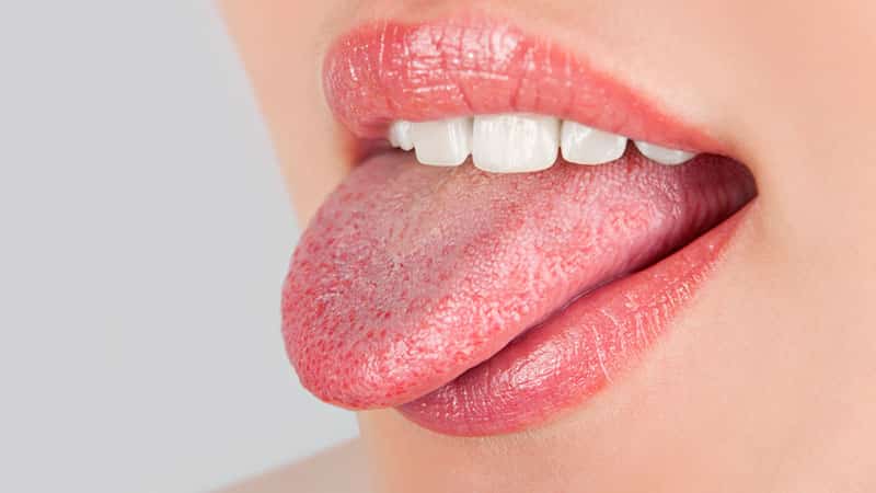 Желтый язык - причина