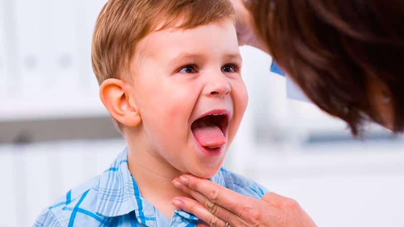 Желтый язык