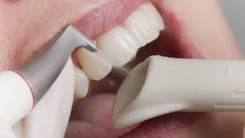 зубная паста для удаления зубного камня