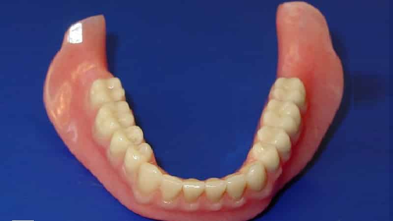 полиуретановый зубной протез фото