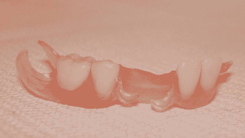 силиконовые протезы для зубов